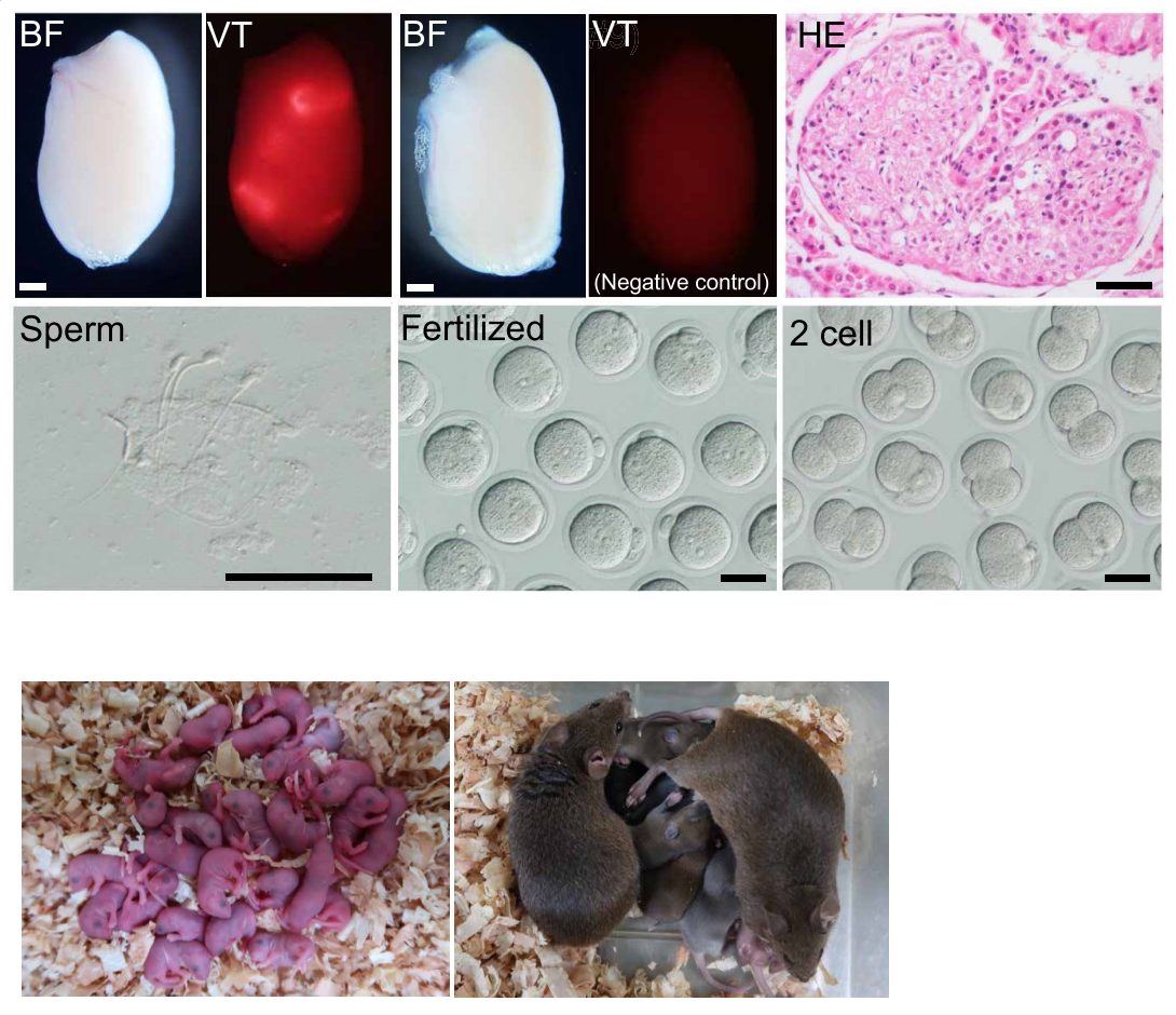 1772512527439597.png 4224469dddbee73358c0ed2e147681dd.png