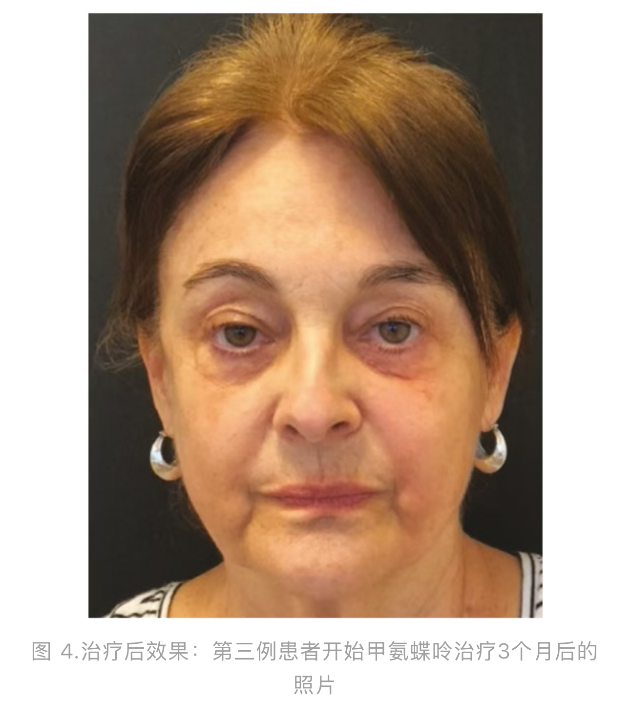 1774577651151373.jpg 1774577651151373.jpg