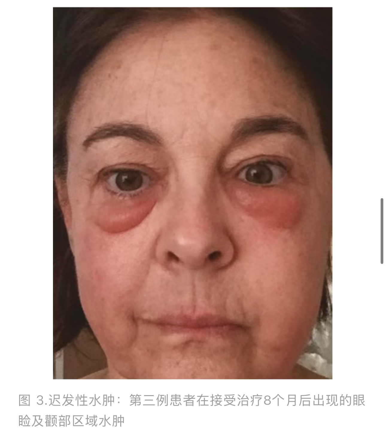 1774577660532306.jpg 1774577660532306.jpg