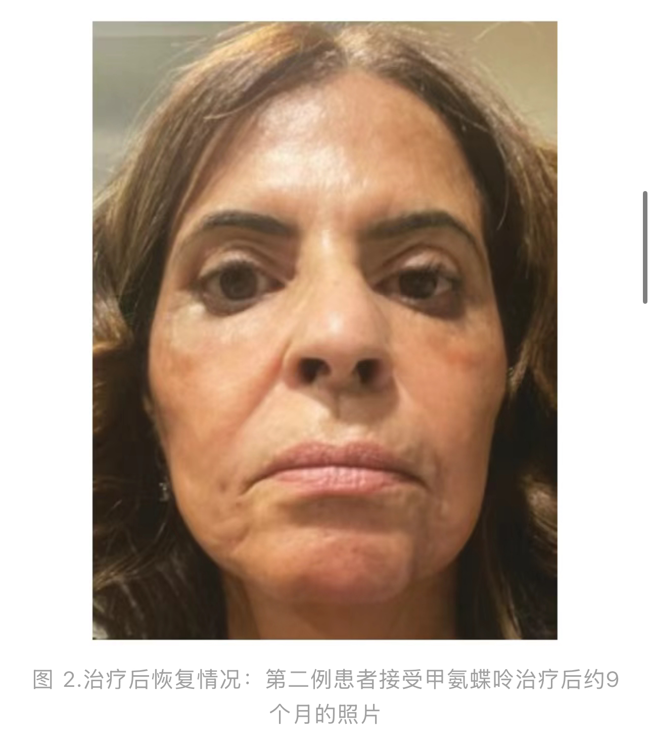 1774577710725276.jpg 1774577710725276.jpg