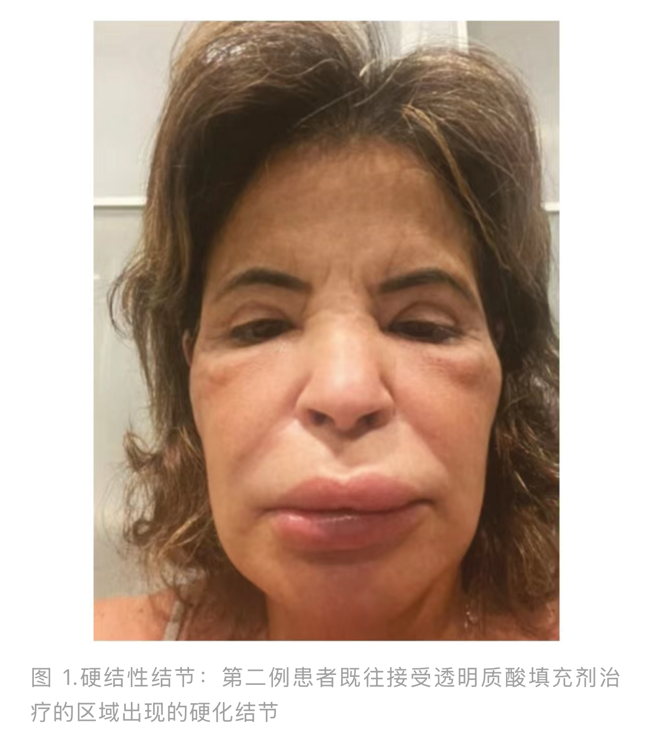 1774577735339532.jpg 1774577735339532.jpg