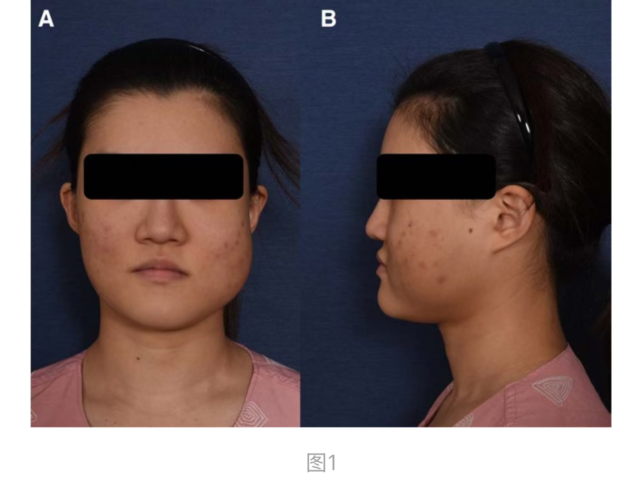 1774590906717552.jpg 1774590906717552.jpg