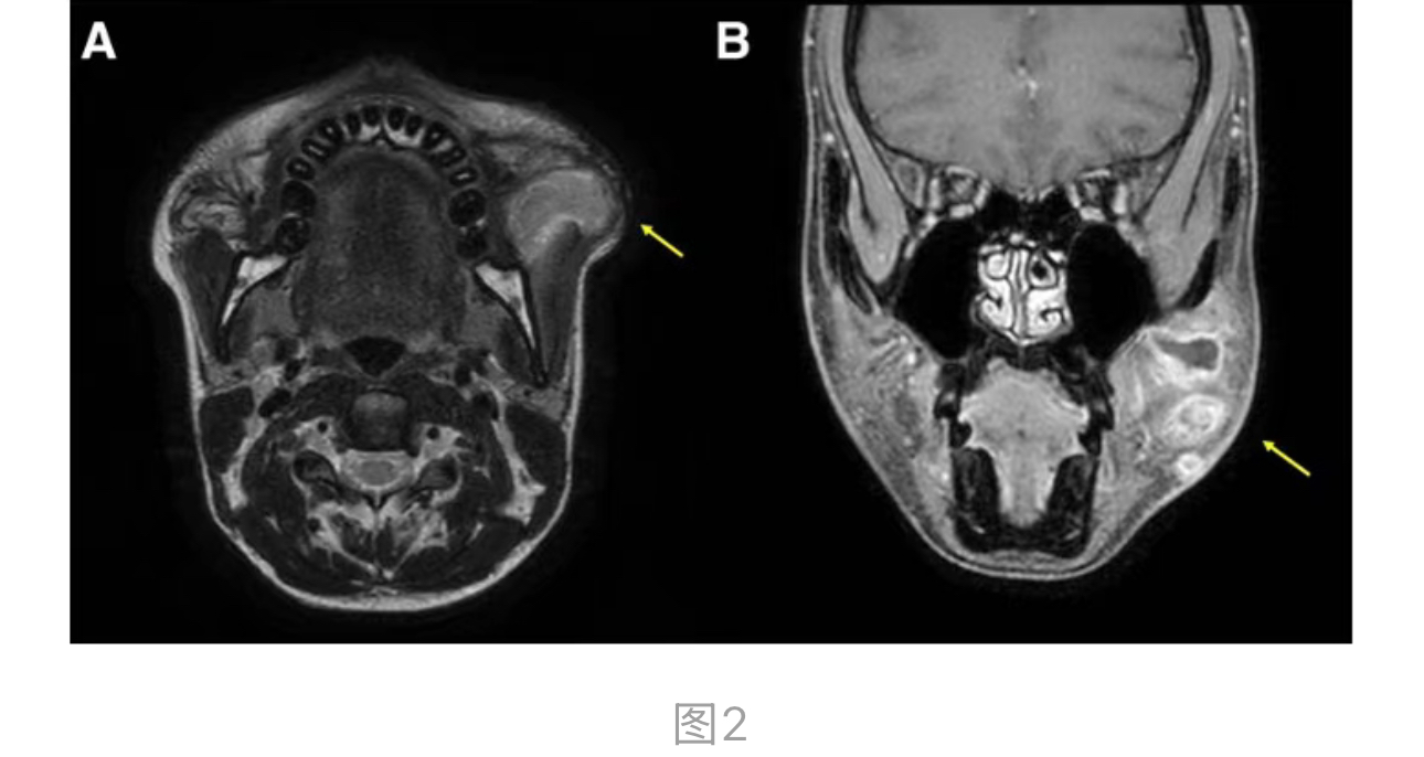 1774590915670361.jpg 1774590915670361.jpg