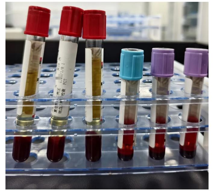 1774839115868447.jpg 1774839115868447.jpg