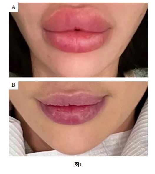 1775091638994756.jpg 1775091638994756.jpg